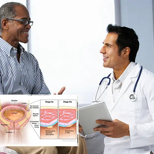 Welcome to  UroPartners, LLC 
Your Guide Through Penile Implant Surgery