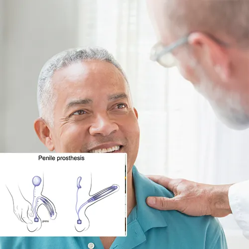 Understanding Penile Injection Therapy: A Guide for Men Exploring ED Treatments